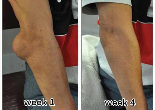 Cougex™ Arthritis Massage Gel with Turmeric & Emu Oil image Cougex™ Arthritis Massage Gel with Turmeric & Emu Oil